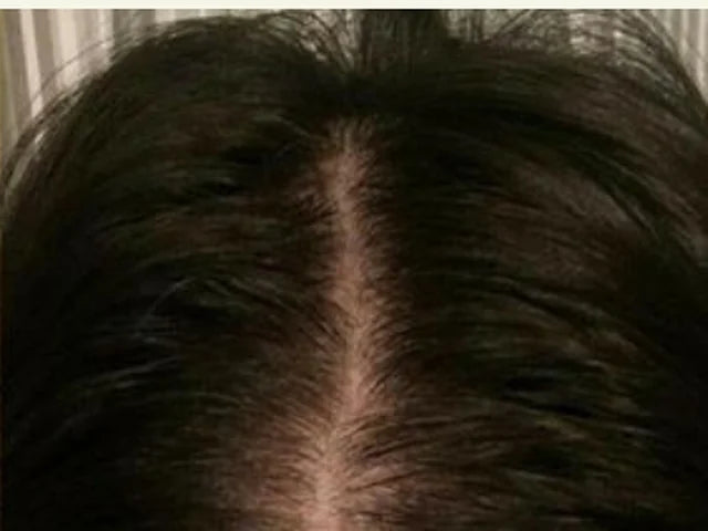 Customer-supplied photograph of the centre parting, after