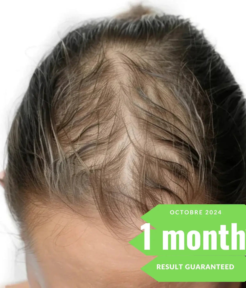 close-up o scalp showing hair regrowth after using afghani oil, with 1 month result guaranteed .