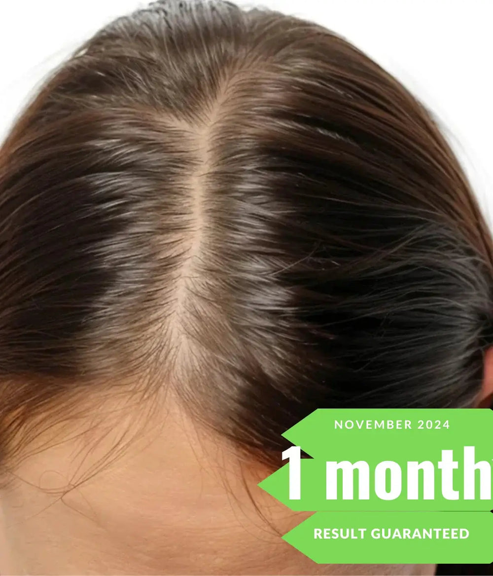 Afghani oil hair growth result after 1 month , healthier hair with guaranteed results.