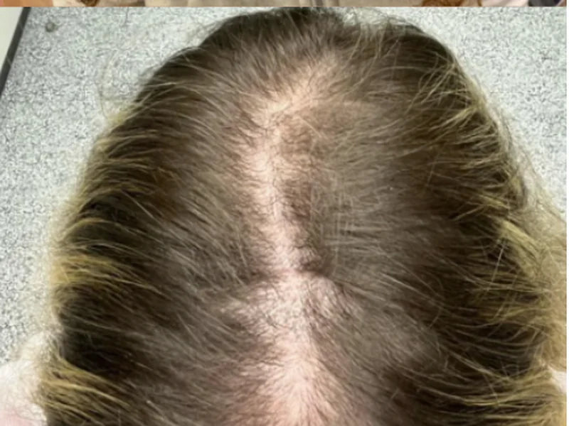 Customer-supplied photograph of the parting, top view, before