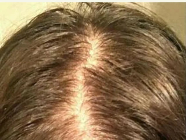 Customer-supplied photograph of the centre parting, before