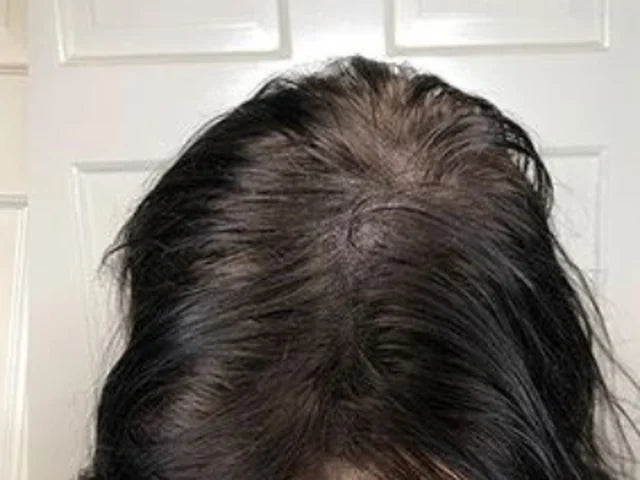 Customer-supplied photograph of the parting, front view, after