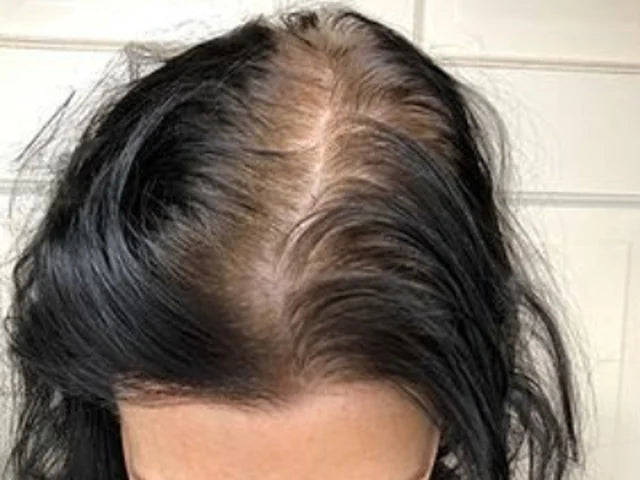 Customer-supplied photograph of the parting, front view, before